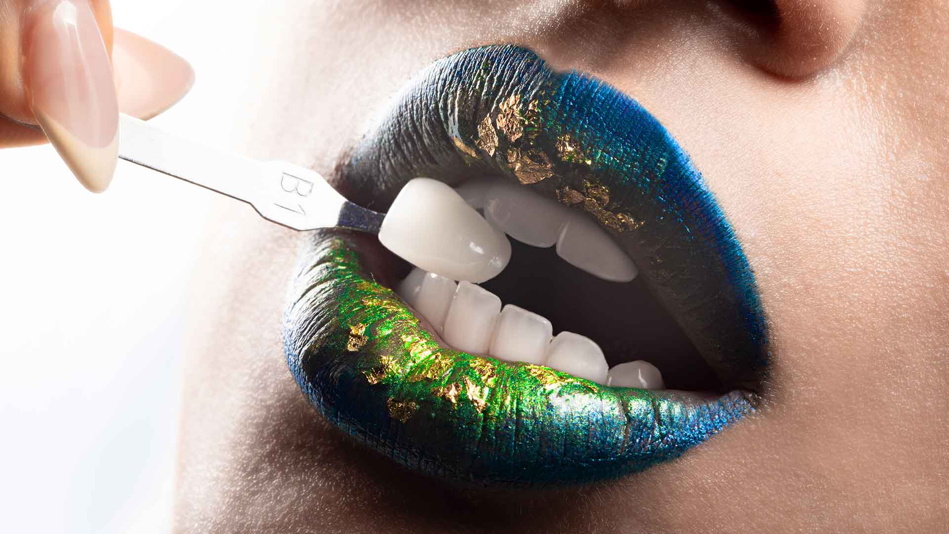 1 Teeth Whitening Professional Worsley Dental Centre