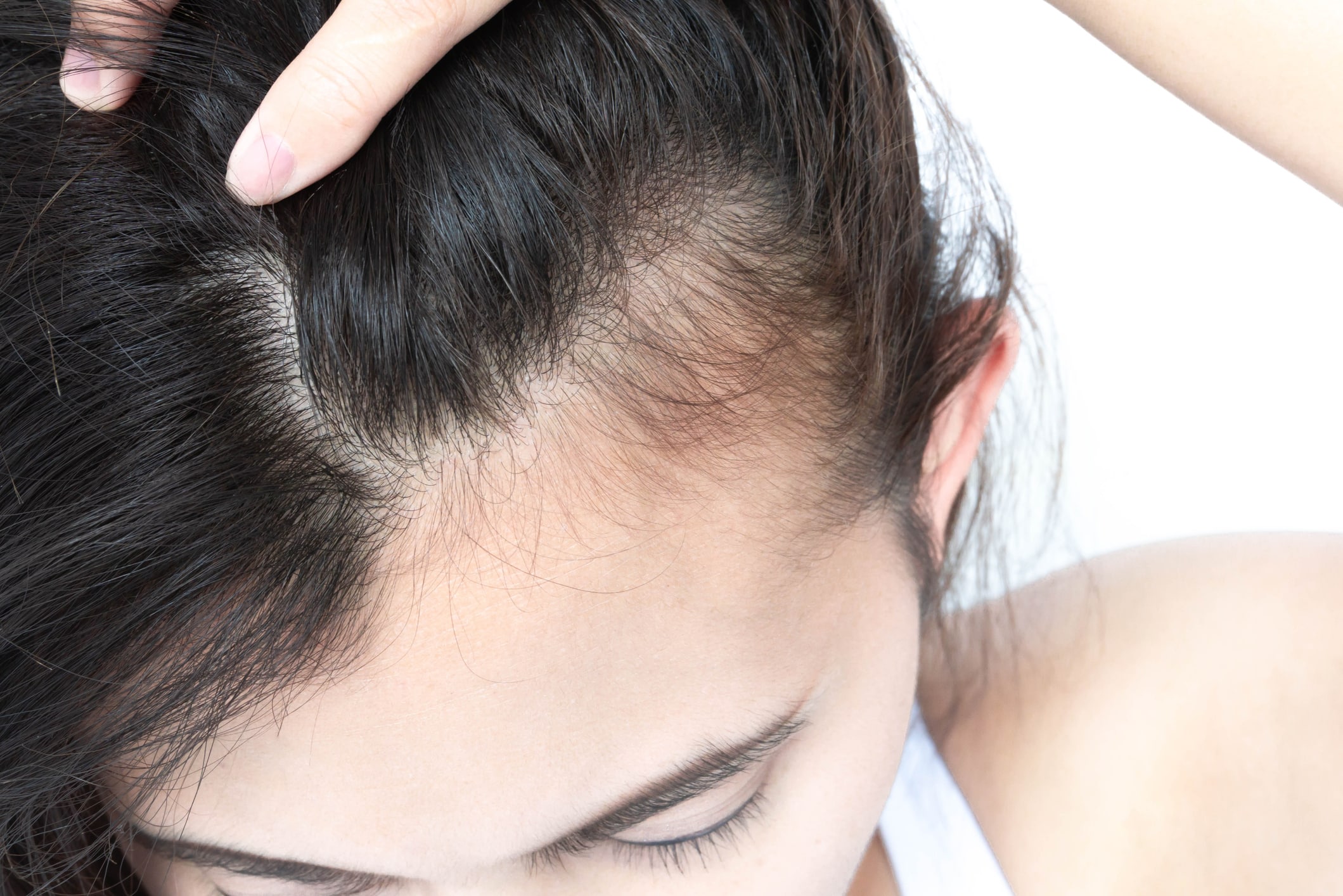 10 Best Products for Postpartum Hair Loss The Lanby