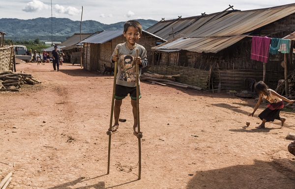 Local Child On Stilts