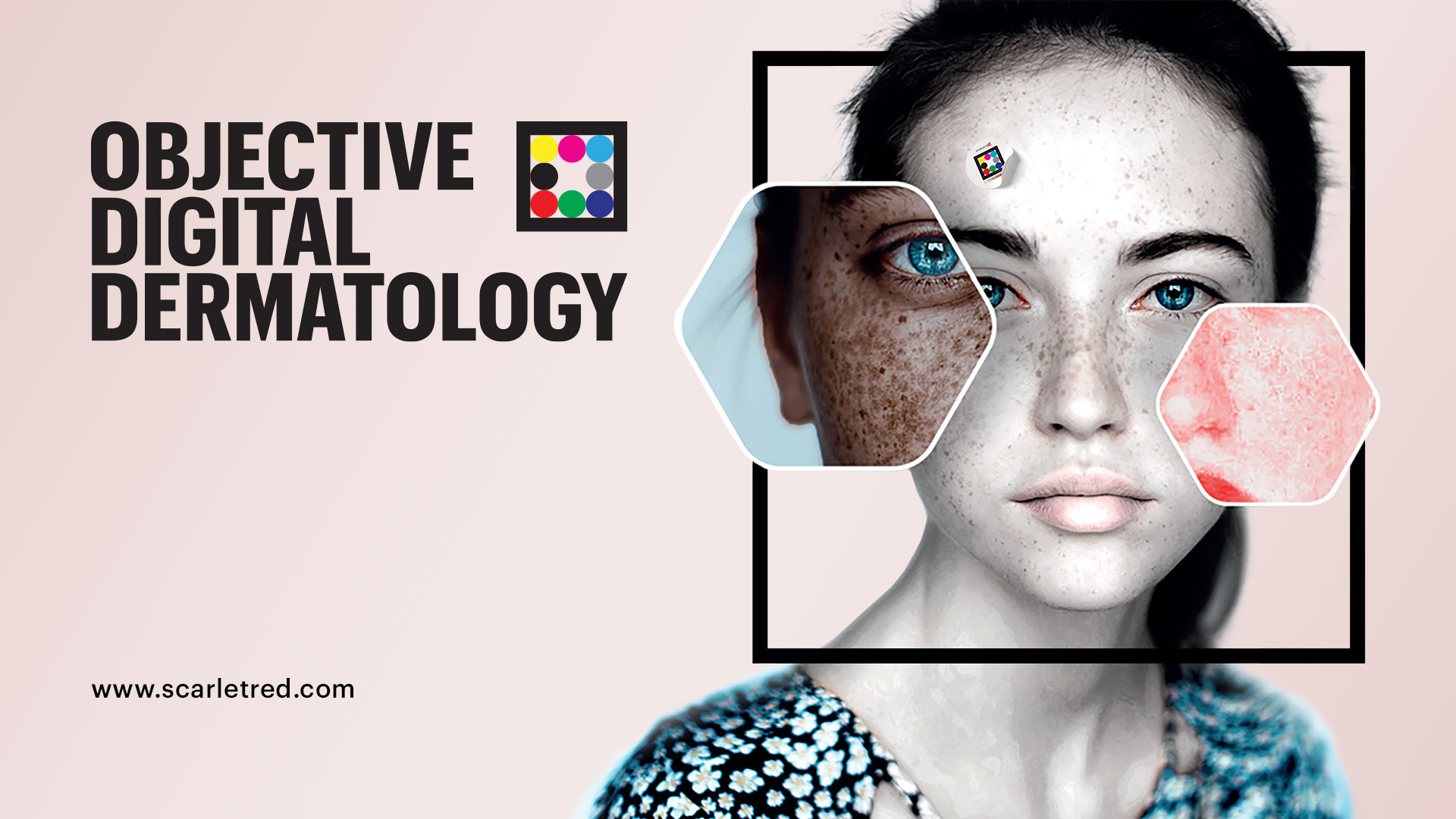 Objective digital dermatology by Scarletred