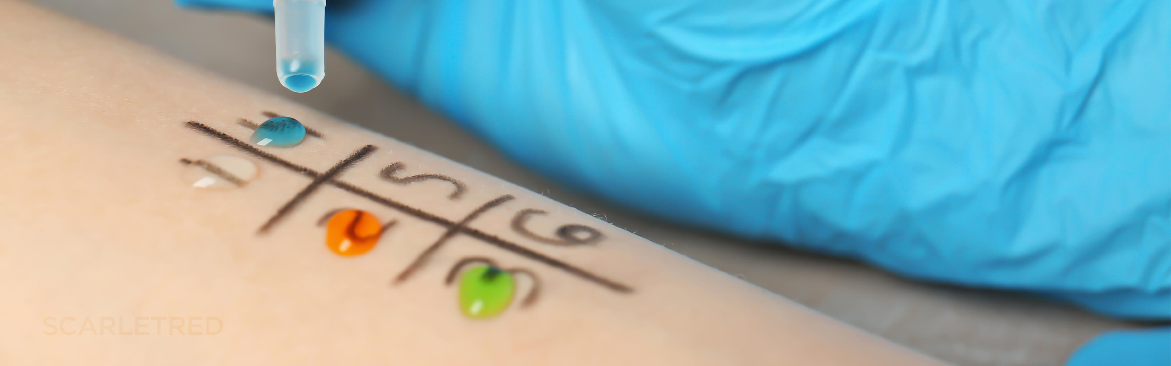 Person wearing blue gloves is testing substances on the skin