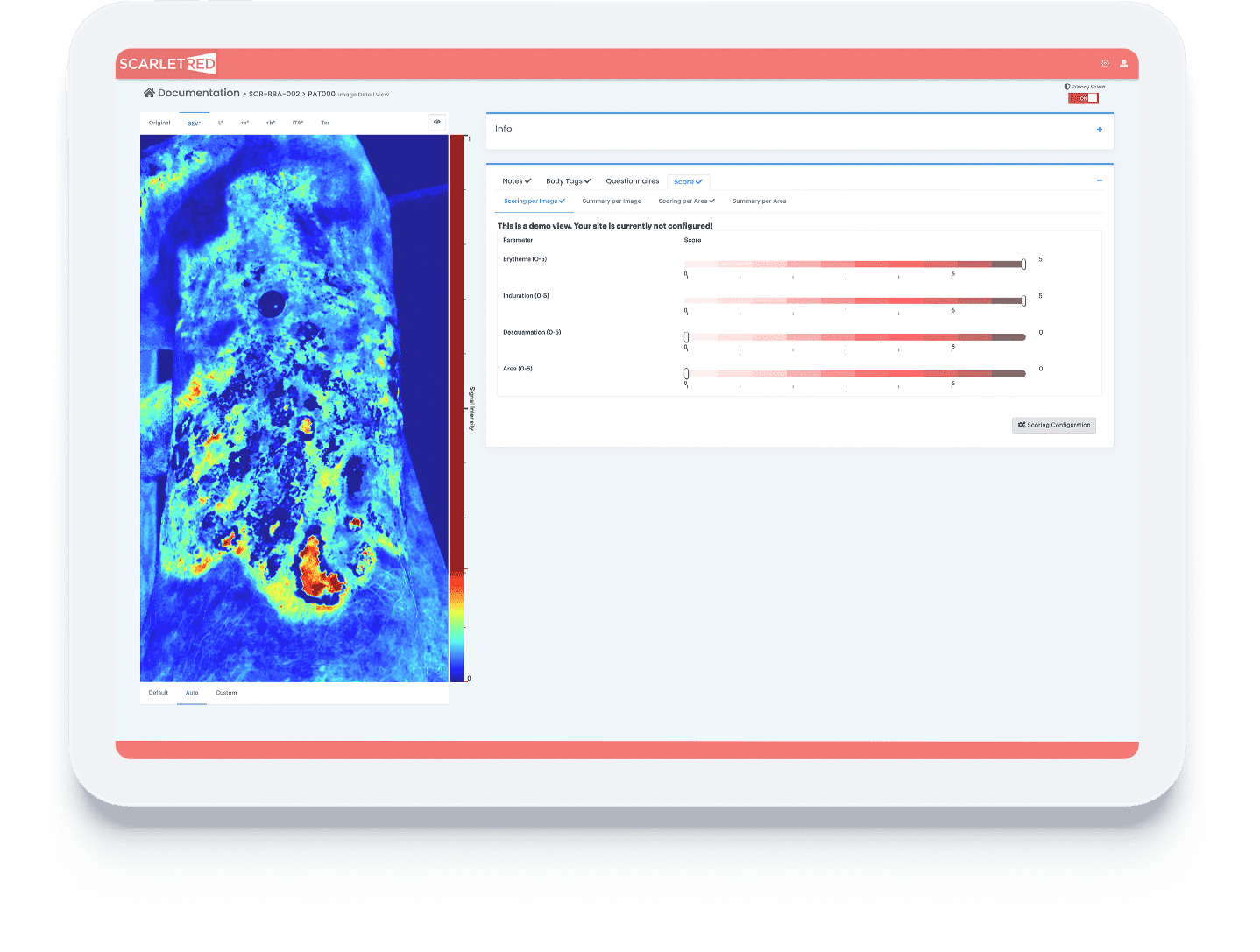 Documentation overview of an epidermolysis bullosa wound on the ScarletredVision online platform