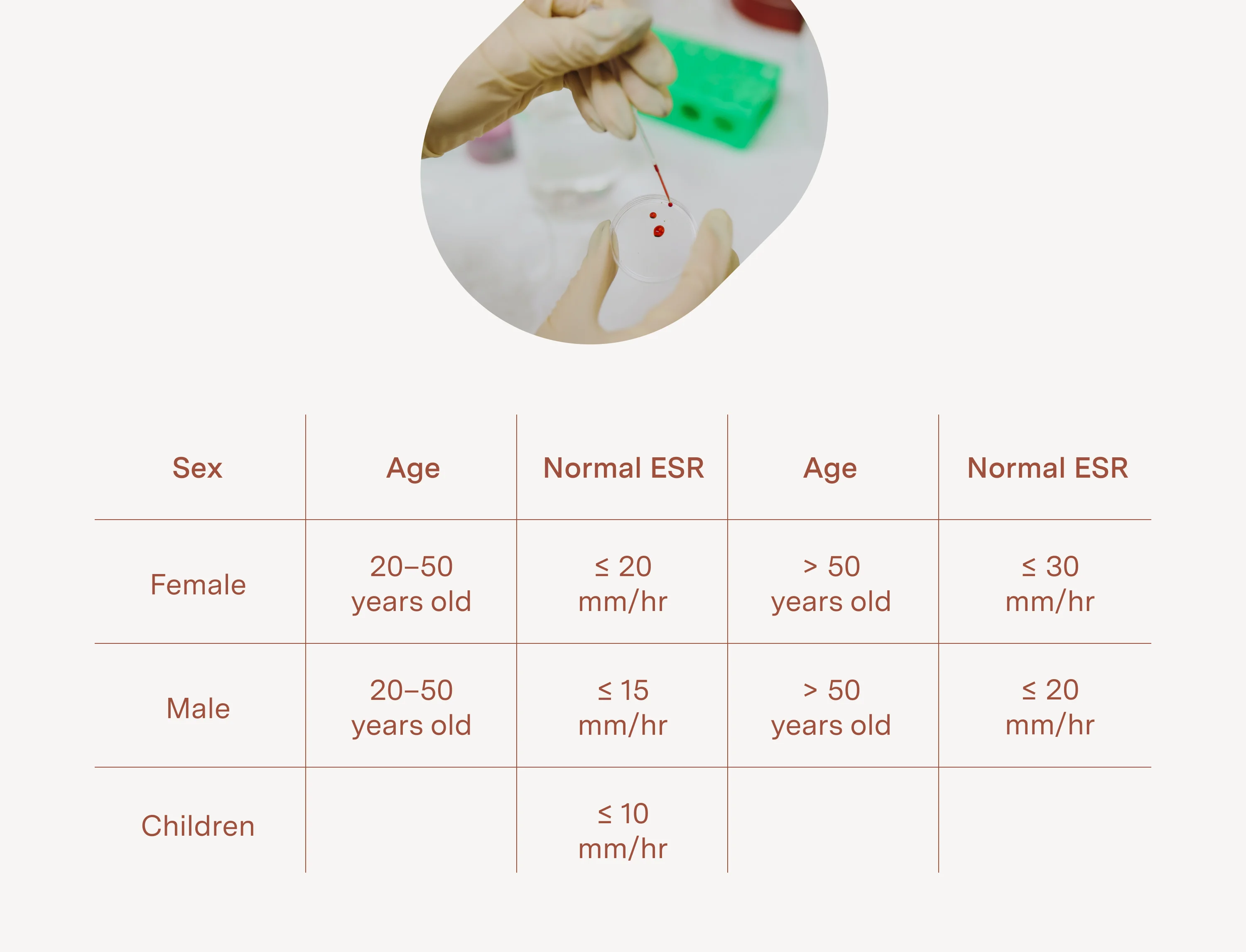 What Is A Normal Sed Rate For Rheumatoid Arthritis What You Need To Know
