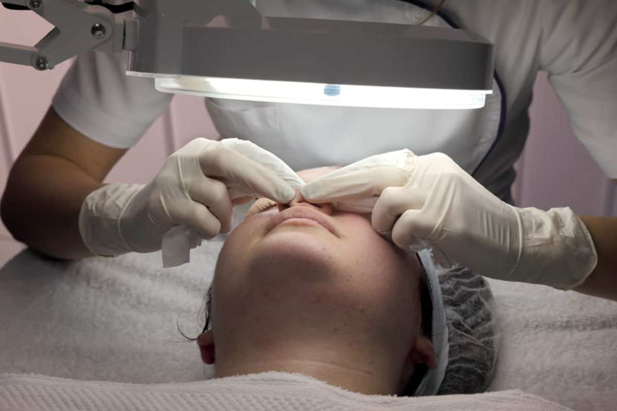 Acne Treatment Clinic Acne Removal Procedures Dermetics