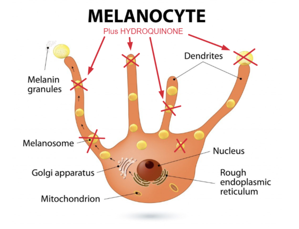 Hydroquinone 4 How Does It Work For Melasma & Where To Buy? Strut Blog