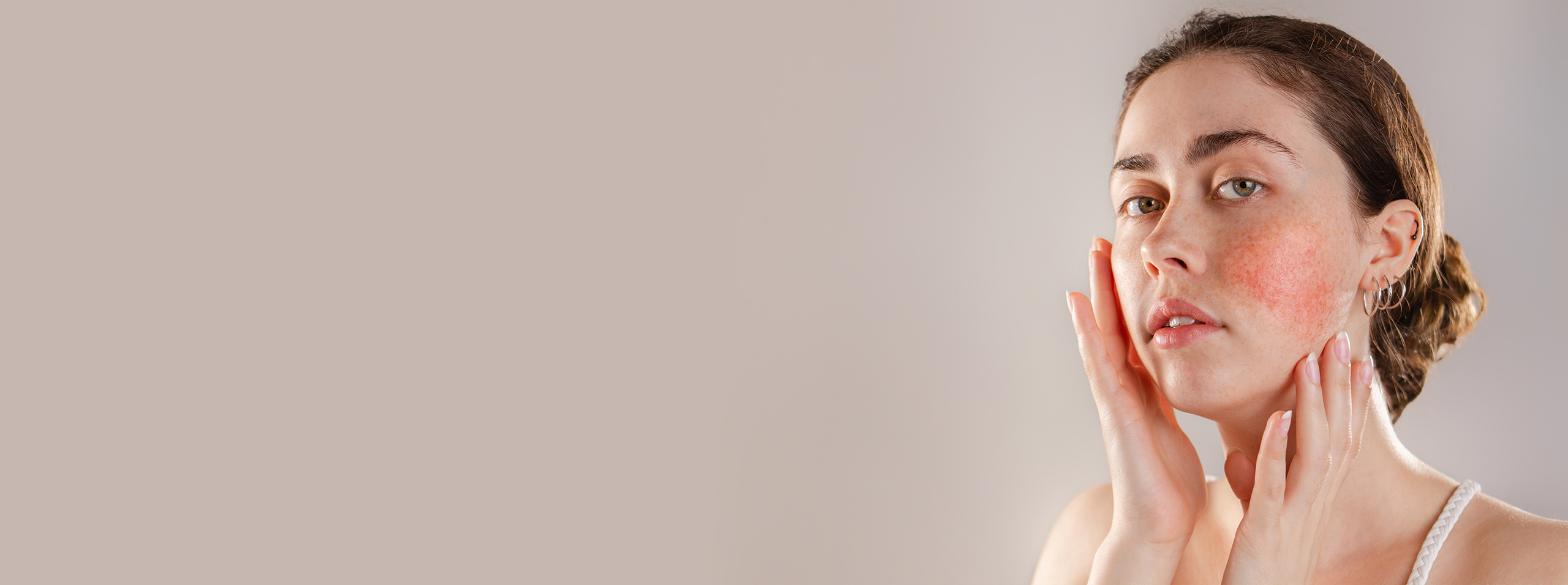 Ivermectin Cream for Rosacea What Is It, How It Works, and Where To