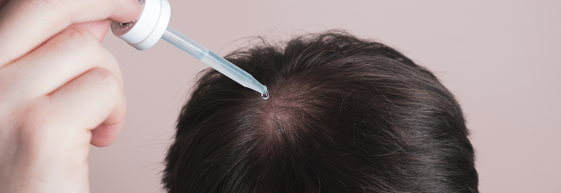 Fluocinolone in Hair Loss Formulas FAQs, Benefits, and What To Expect
