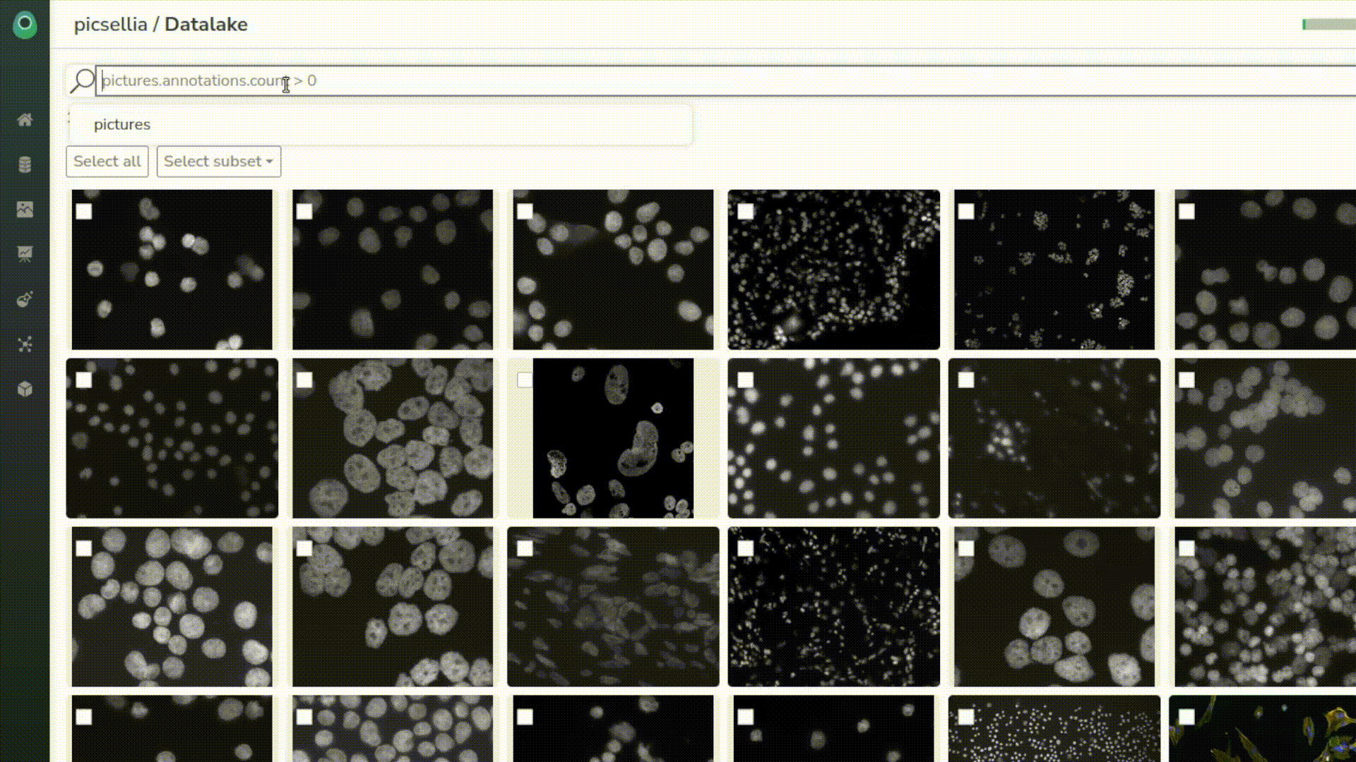 How to Use Computer Vision in Cancer Research With MLOps — Picsellia