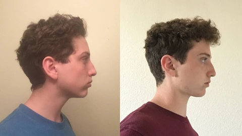 Improved neck posture