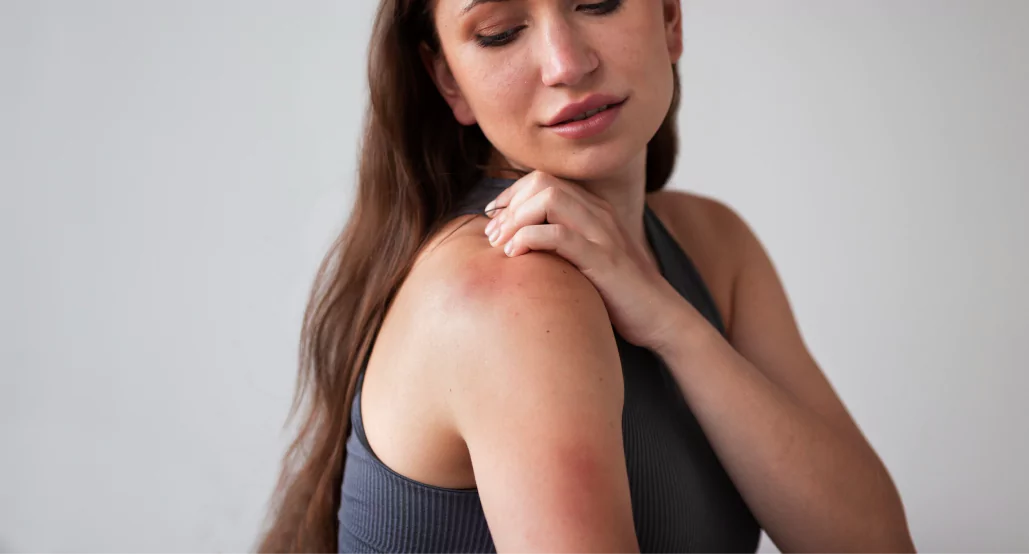 Alcohol and Eczema Signs, Causes and Treatments