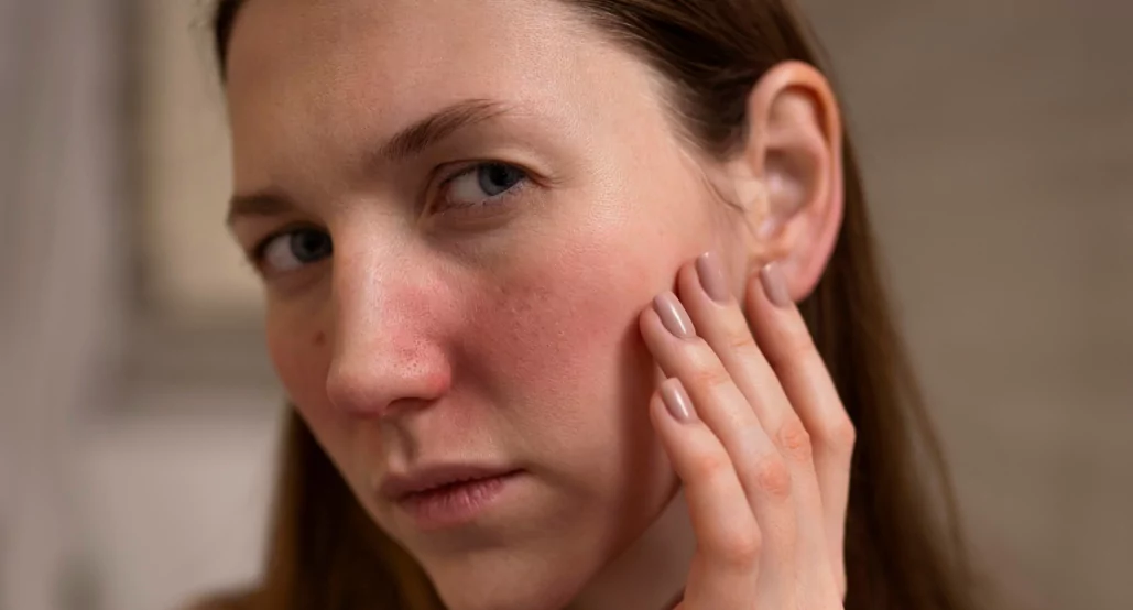 Using Pepcid To Reduce Alcohol Flush Reframe App