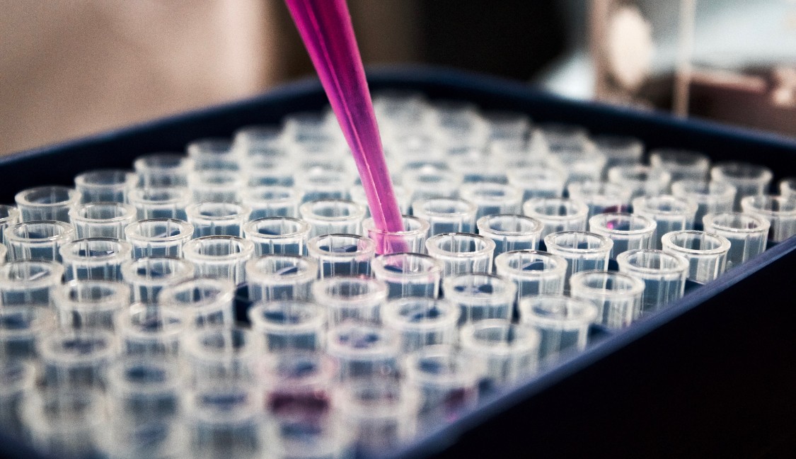 IVDR In Vitro Diagnostic Regulation within the European Union