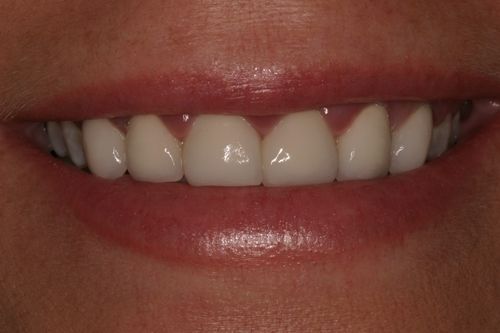 before and after treatment