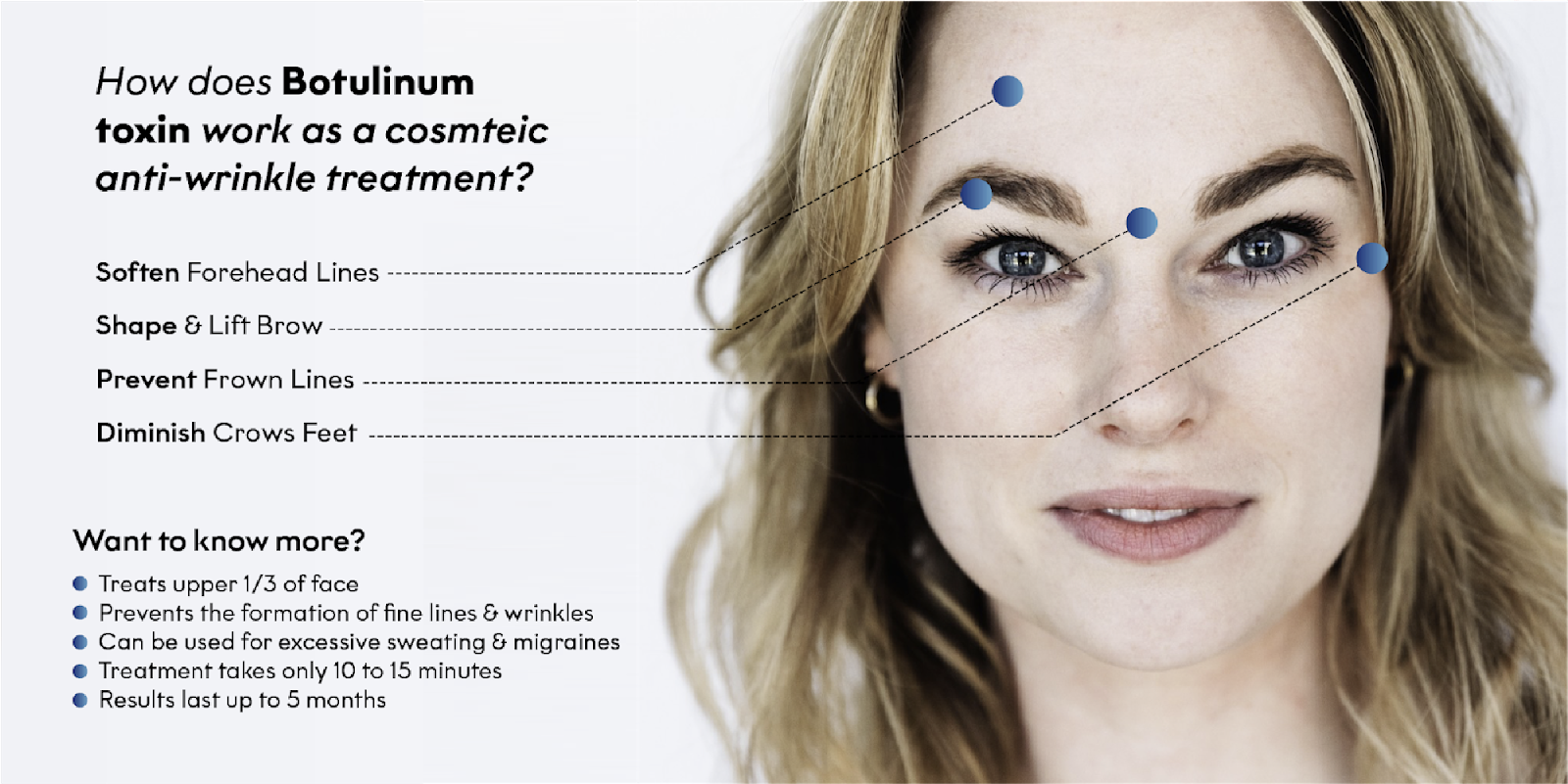 Baby Botox What It Is, How It Works, and Why You Should Try It