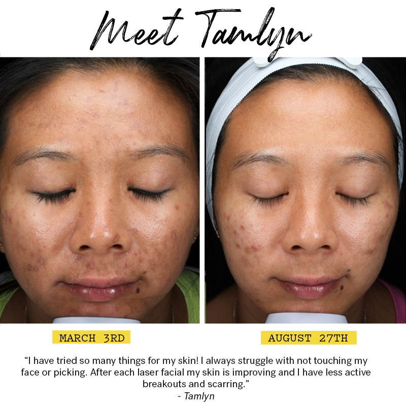 Results Skin Laundry