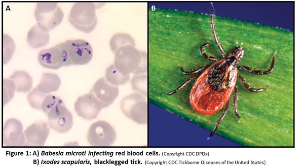 Photo of babesia microti ifecting red blood cells on left and blacklegged tick on right