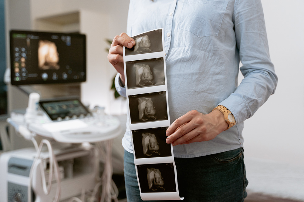 Woman holding ultrasound photos
