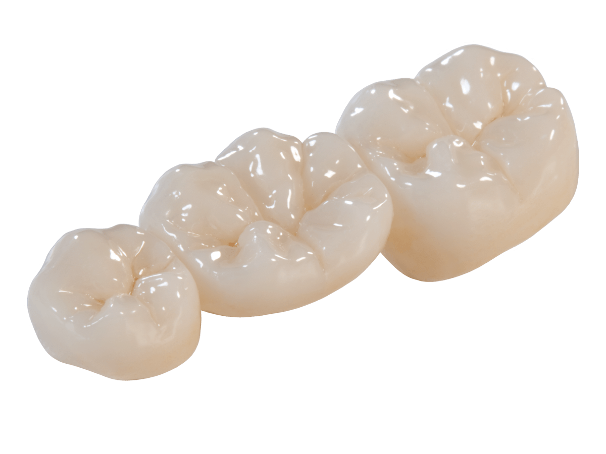 dental bridge