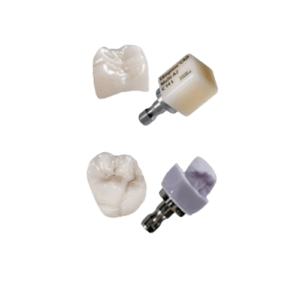 dental implants