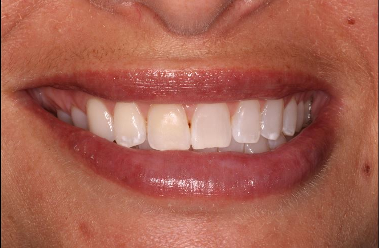 before and after treatment