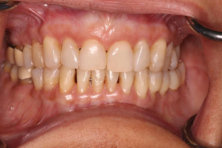 before and after treatment