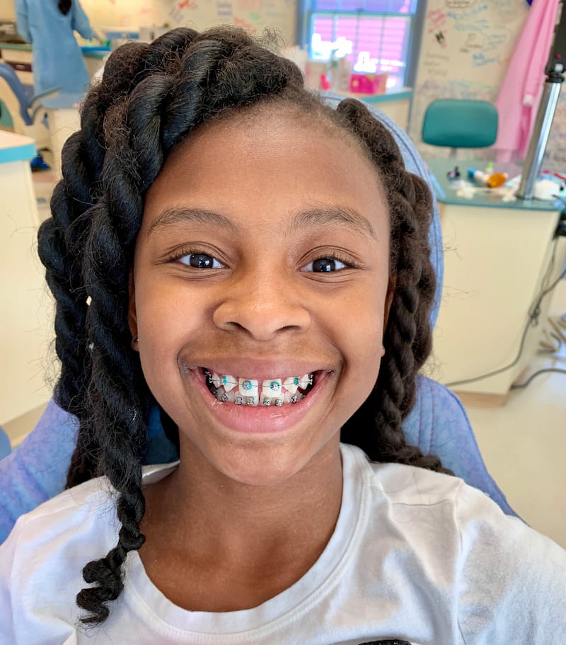 Time for Braces? 7 Signs to Watch for in Your Child