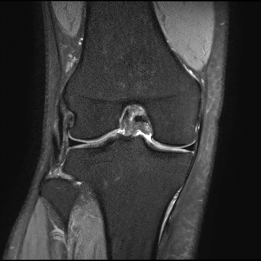 radiologiehoch3 Knie