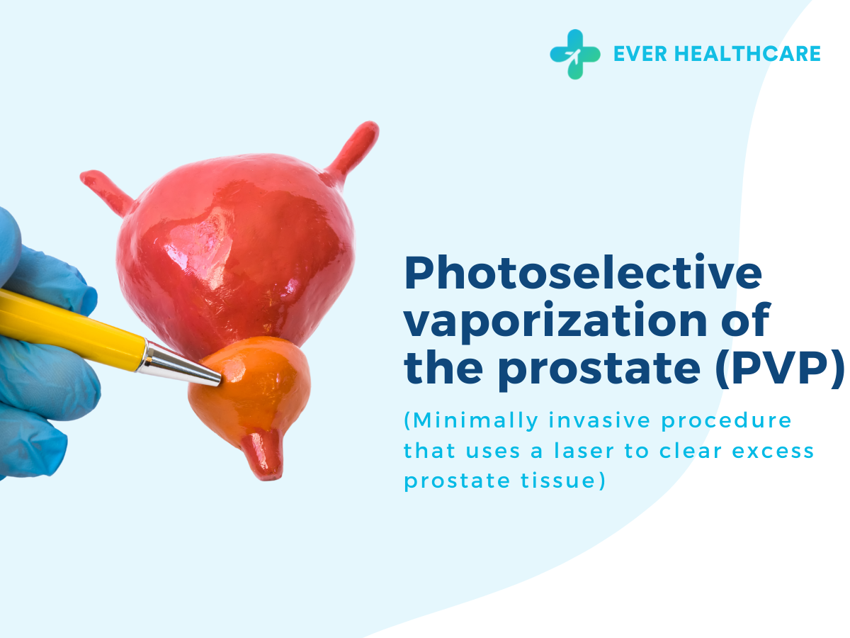 Plasma Vaporization Of The Prostate – PXIV