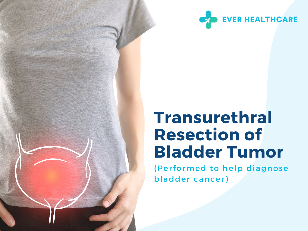 Understanding Turbt: Bladder Tumor Removal Surgery – JZIPJK