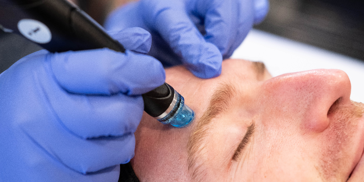 Study Finds Hydrafacial Improves Acne Restore Hyper Wellness