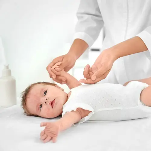 Baby Eczema and the Gut Microbiome