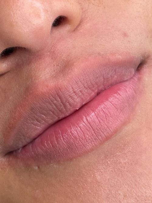 Cosmetic Surgery Sacramento Med Spa El Dorado Hills Esthetics Center