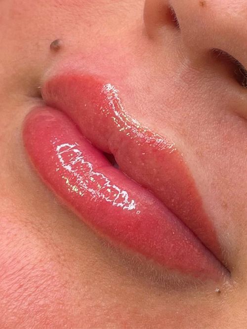 Cosmetic Surgery Sacramento Med Spa El Dorado Hills Esthetics Center