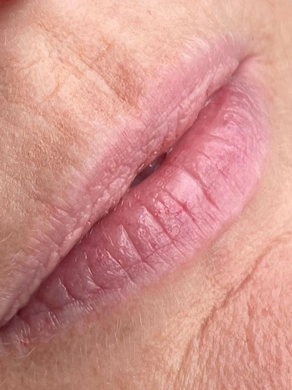 Lip Blushing in El Dorado Hills, Sacramento & Rocklin Esthetics Center