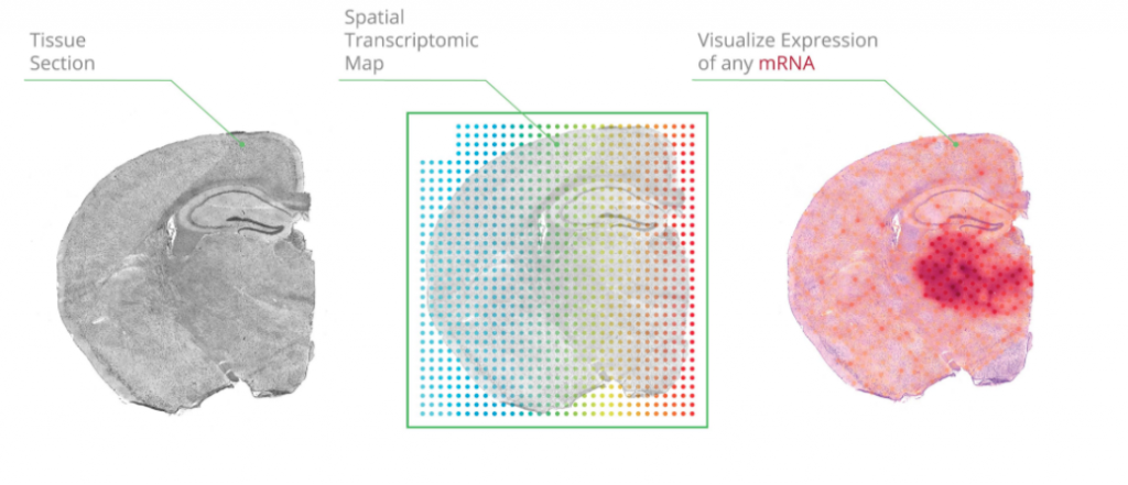 Imaging the Transcriptome with Spatial Transcriptomics