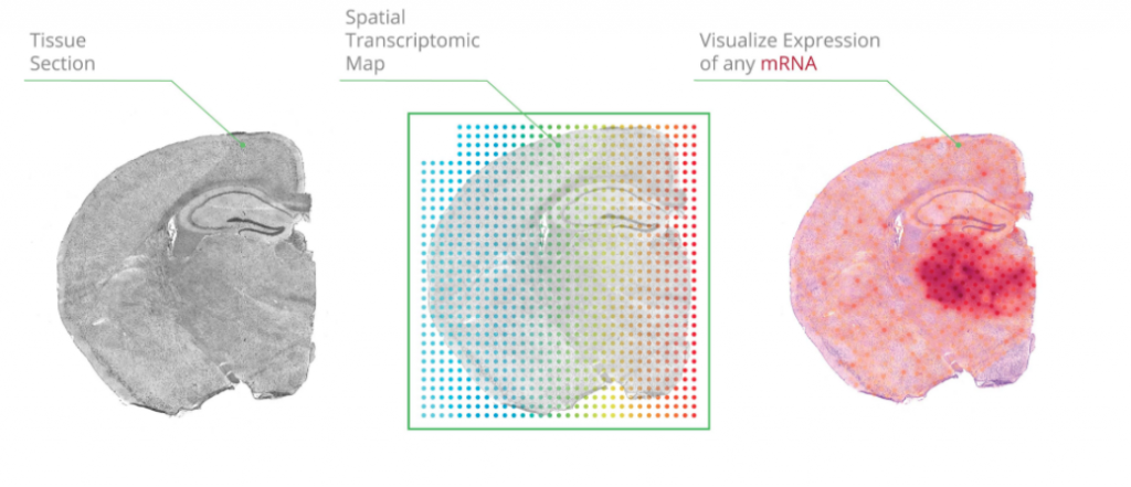 Imaging the transcriptome with Spatial Transcriptomics 