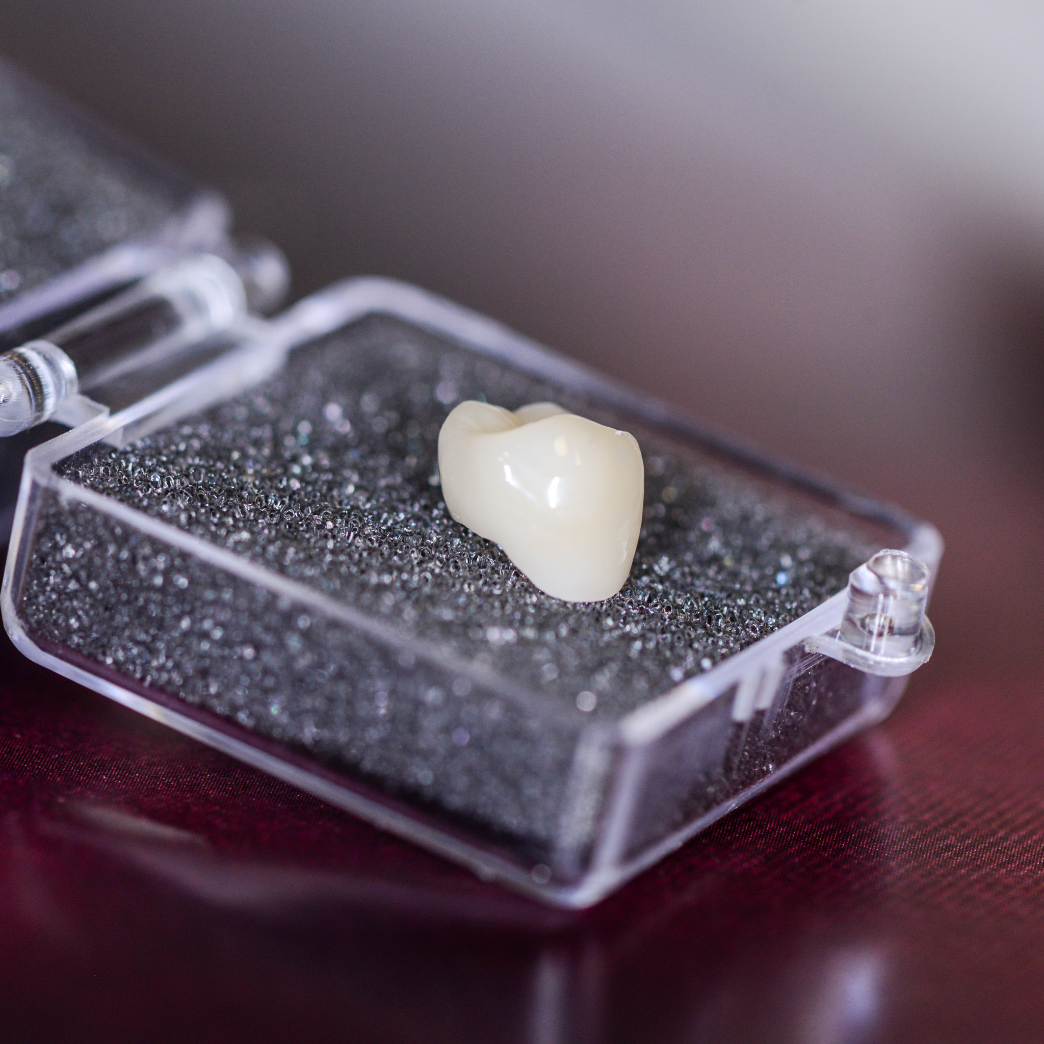 How Much Does A Crown Cost In BC?