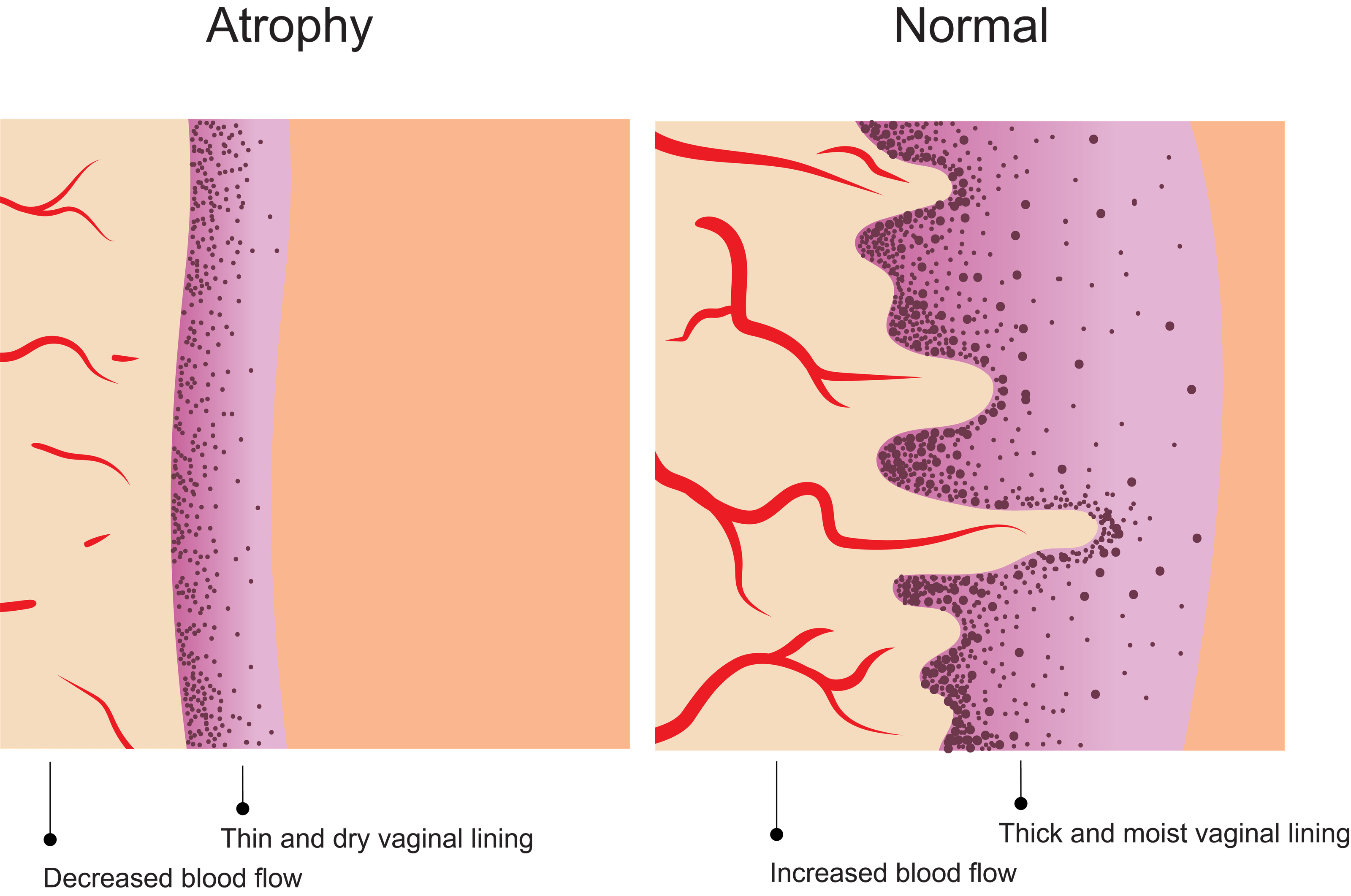 Midi Custom Rx Shop DHEA/Estradiol Cream