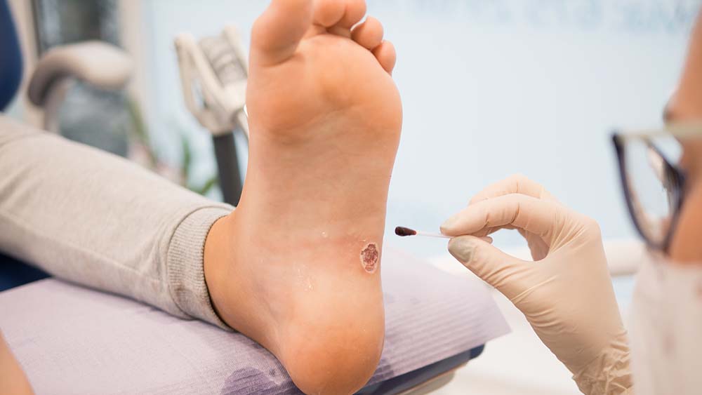 Podiatrist in Altrincham UK Podiatry 0161 929 7272