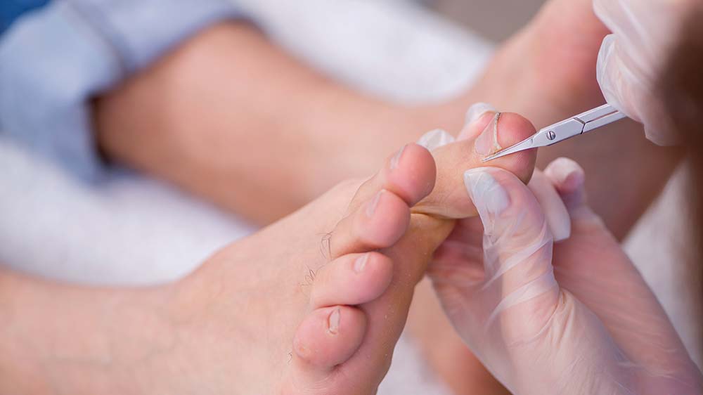 Podiatrist in Altrincham UK Podiatry 0161 929 7272