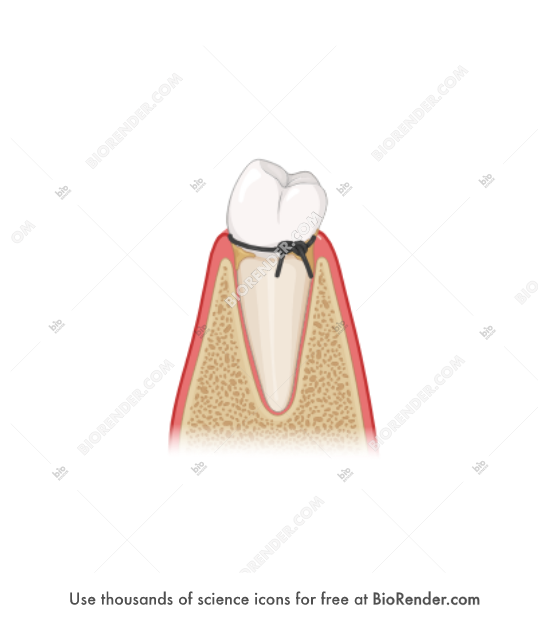 Free Tooth (premolar, gingivitis, ligature) Icons, Symbols & Images