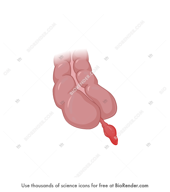 Free Appendix (appendicitis, swollen) Icons, Symbols & Images BioRender