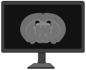MRI image (coronal mouse brain)