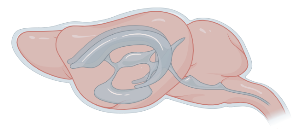 Mouse brain (lateral, with ventricles)