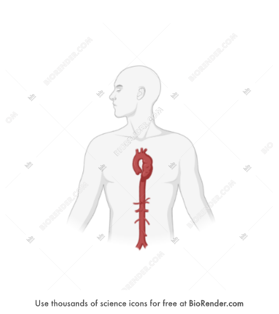 Adult (with aneurysm of descending thoracic aorta) - Editable icon of an anterior view of an adult male upper body with its head turned to the side with an aneurysm bulge of the descending thoracic aorta