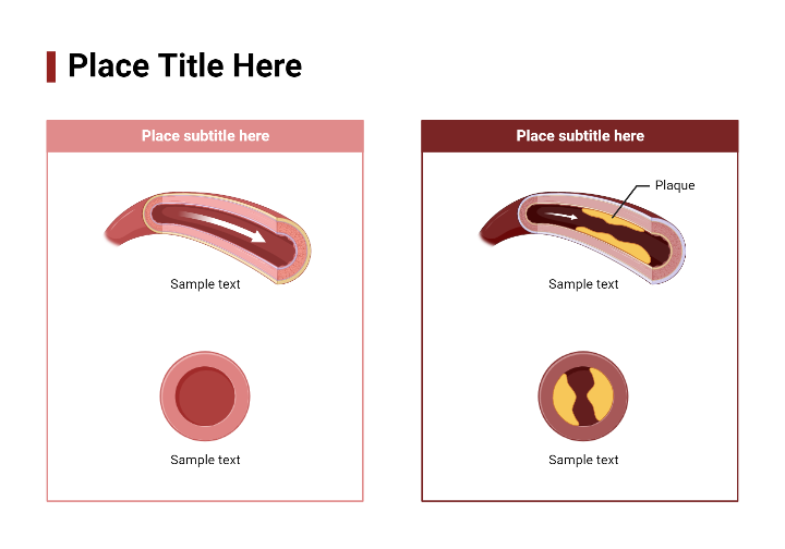 Artery Comparison (Layout 2x1)) | BioRender Science Templates