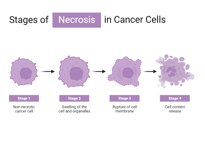 Stage of Necrosis in Cancer Cells BioRender Science Templates