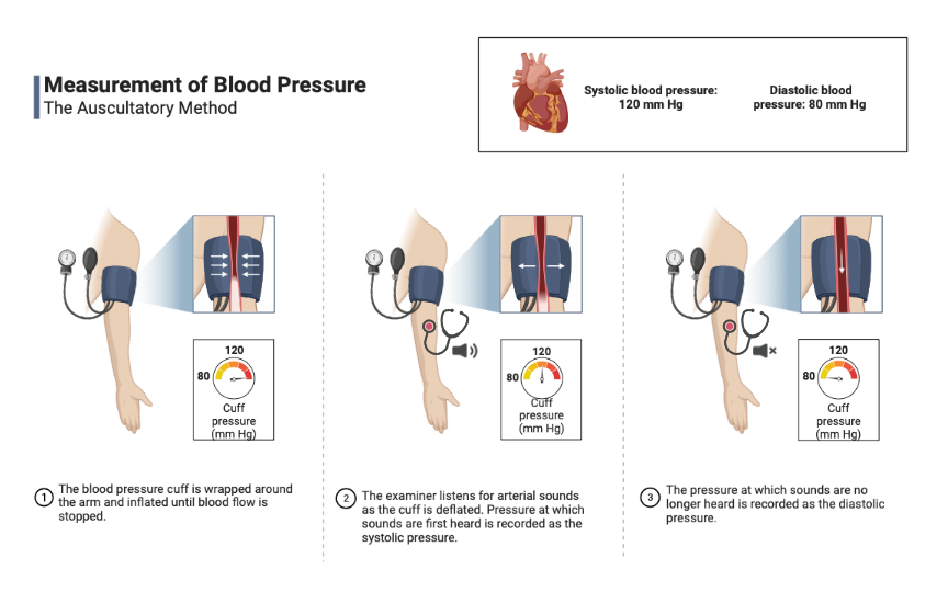 Measurement Of Blood Pressure The Auscultatory Method BioRender 