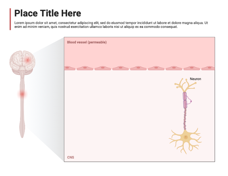 Multiple Sclerosis Cns With Callout Layout Biorender Science Templates Multiple Sclerosis Cns With Callout Layout Biorender Science Templates