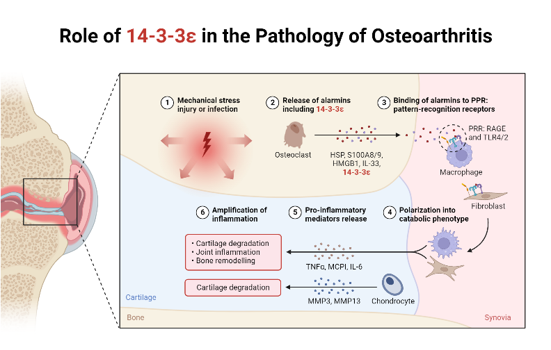 Pathology Of Osteoarthritis
